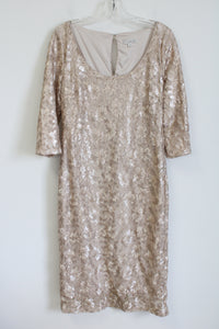 Eva Mendes Gold Lace Dress | 10